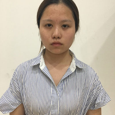 上海九院陈付国做鼻子怎么样?案例_价格_口碑