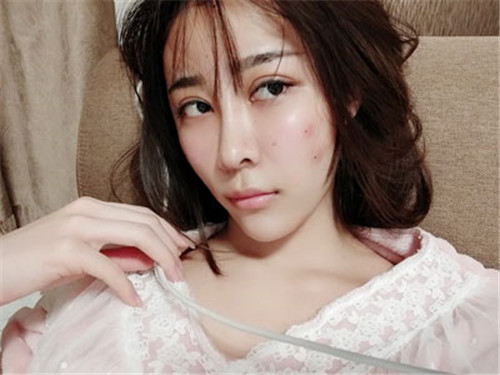 北京韩啸郑京桓自体脂肪移植怎么样?案例_价格_口碑