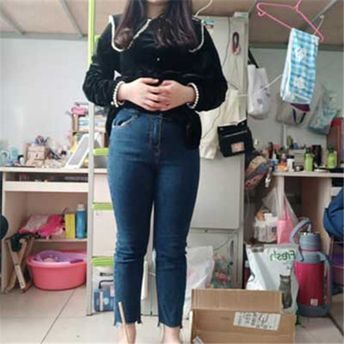 上海美希杨清建吸脂怎么样?案例_价格_口碑