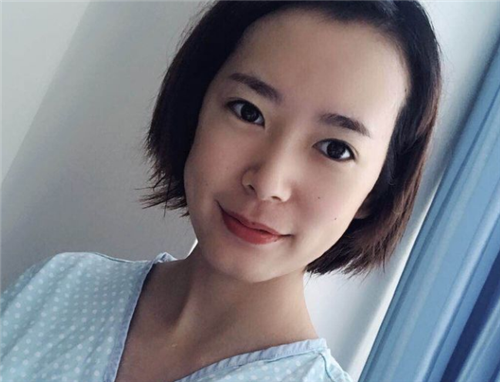 北京爱多邦王绍国自体脂肪填充怎么样?案例_价格_口碑