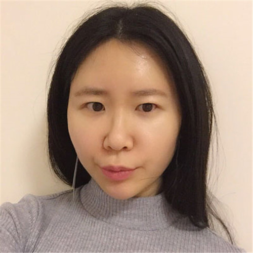北京韩啸姜辉自体脂肪移植怎么样?案例_价格_口碑