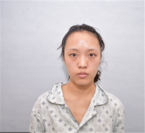 上海玫瑰张东旭自体脂肪填充怎么样?案例_价格_口碑