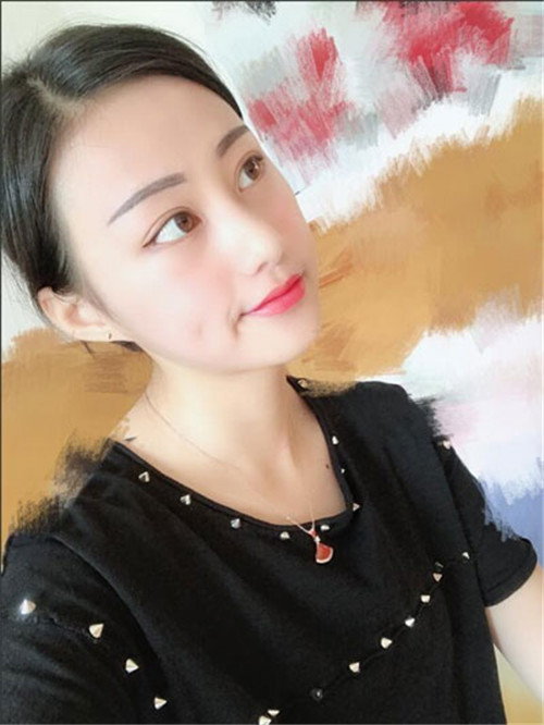 上海德琳朱麟自体脂肪填充怎么样?案例_价格