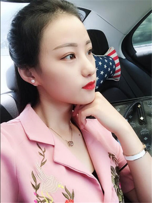上海德琳朱麟自体脂肪填充怎么样?案例_价格