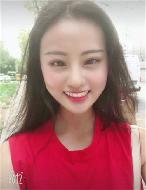 上海德琳朱麟自体脂肪填充怎么样?案例_价格