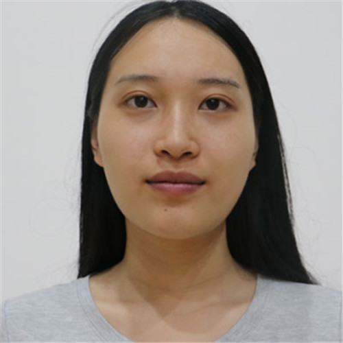 上海九院戴传昌做鼻子怎么样?案例_价格