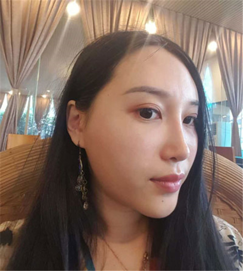 上海九院戴传昌做鼻子怎么样?案例_价格