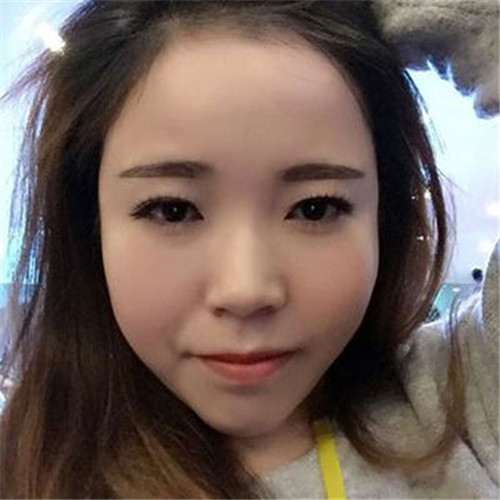 北京柏丽于海军做鼻子怎么样?案例_价格