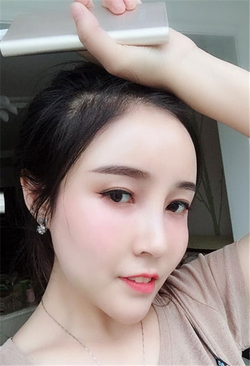 北京柏丽于海军做鼻子怎么样?案例_价格