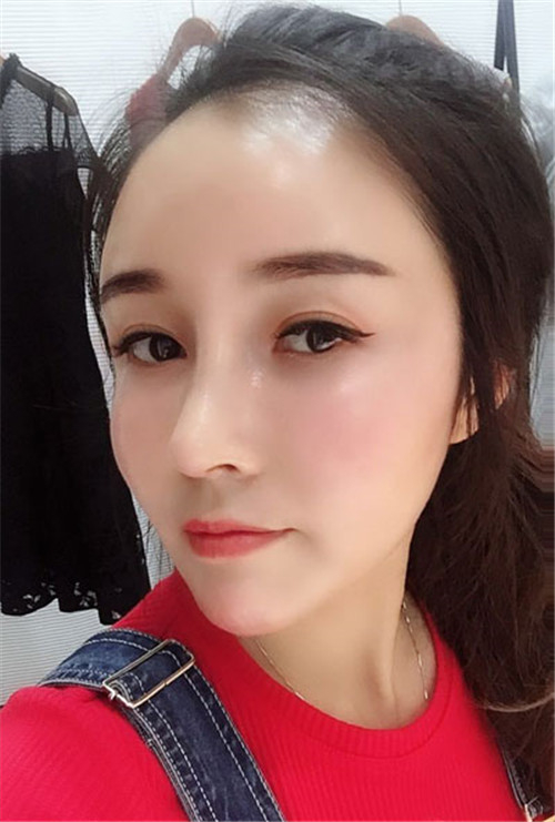 北京柏丽于海军做鼻子怎么样?案例_价格