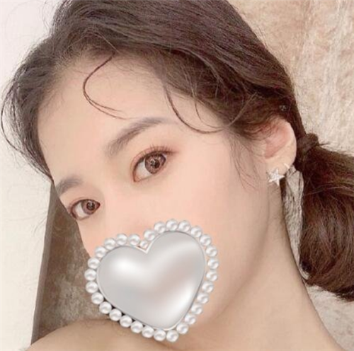 北京爱悦丽格赵映贤割双眼皮怎么样?案例_价格