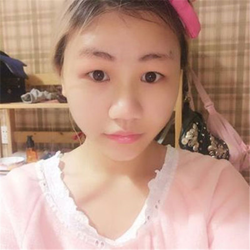 北京艺星做鼻子怎么样?案例_价格