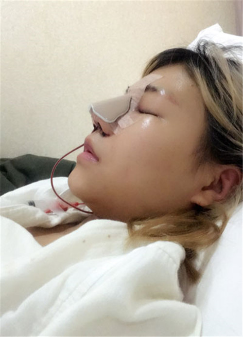 北京艺星做鼻子怎么样?案例_价格