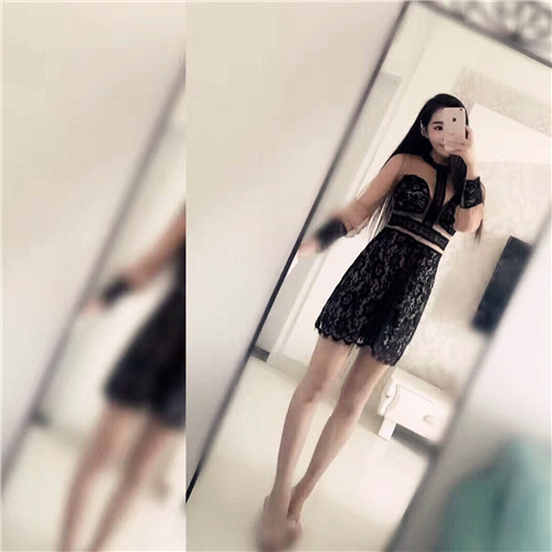 上海玫瑰杨硕成吸脂怎么样?案例_价格