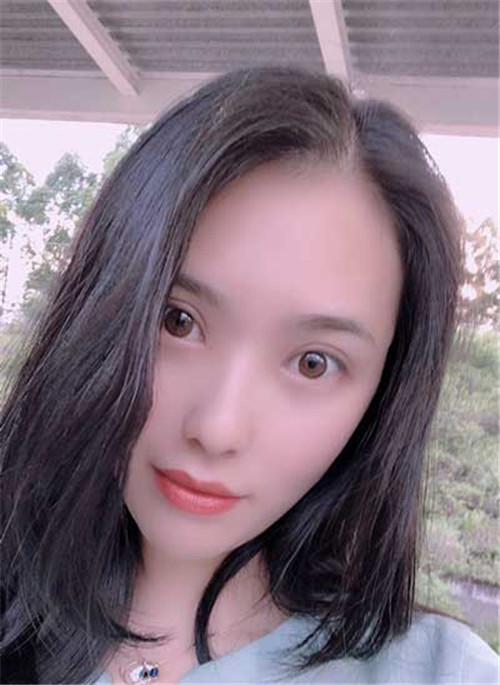 吴海龙割双眼皮怎么样?案例_价格