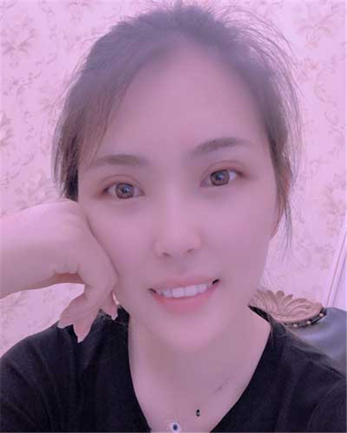 吴海龙割双眼皮怎么样?案例_价格