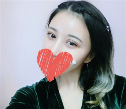 上海艺星许炎龙割双眼皮怎么样?案例_价格