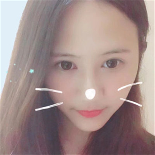 北京联合丽格邢新割双眼皮怎么样?案例_价格