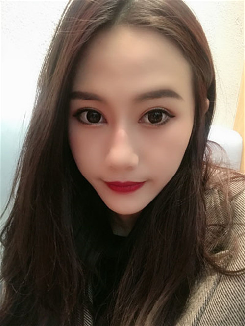 北京联合丽格邢新割双眼皮怎么样?案例_价格