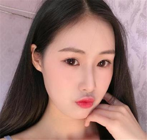 上海华美李健做鼻子怎么样?案例_价格