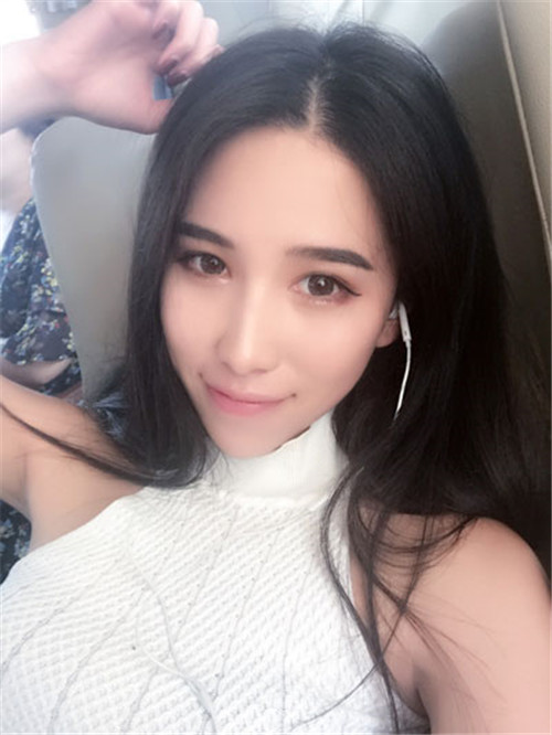 北京联合丽格吴焱秋割双眼皮怎么样?案例_价格