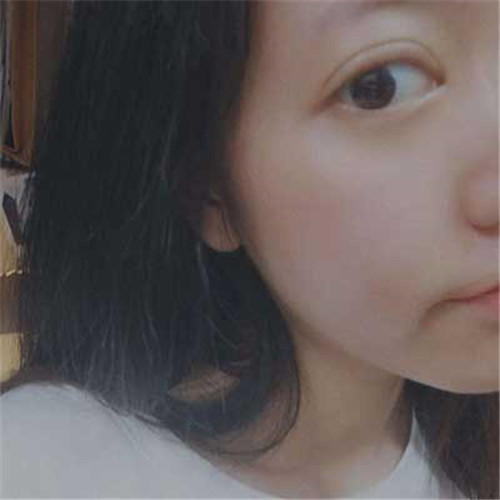 上海华美许再荣割双眼皮怎么样?案例_价格