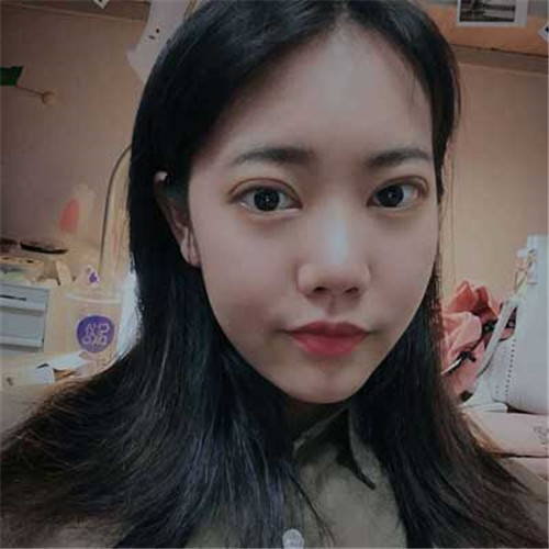 上海华美许再荣割双眼皮怎么样?案例_价格