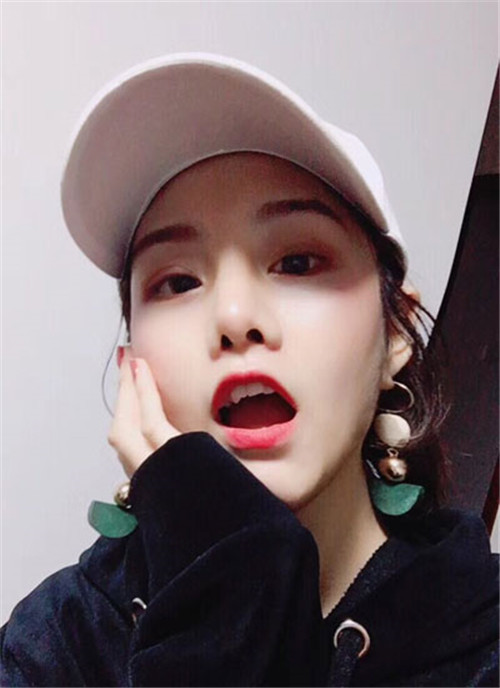 上海德琳段晓光做鼻子怎么样?案例_价格口碑