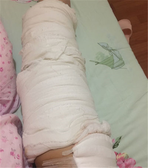 上海安缦刘思达吸脂怎么样?案例_价格口碑
