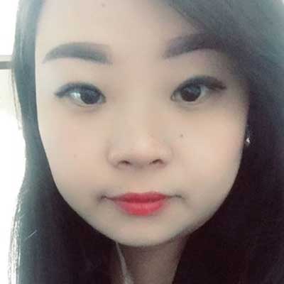 上海艺星杨国正割双眼皮怎么样?案例,价格