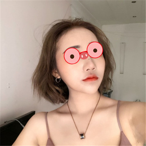 上海艺星许炎龙割双眼皮怎么样?案例,价格