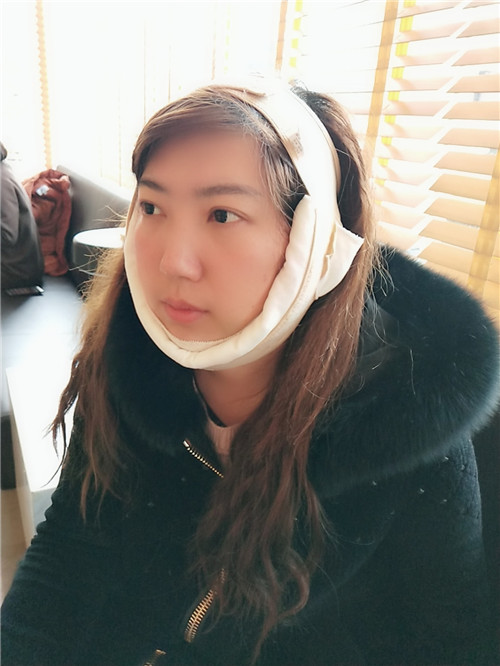 上海薇琳杨荣华吸脂怎么样?案例,价格