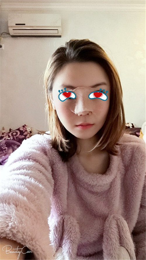 上海联合丽格范荣杰隆鼻怎么样?案例,价格