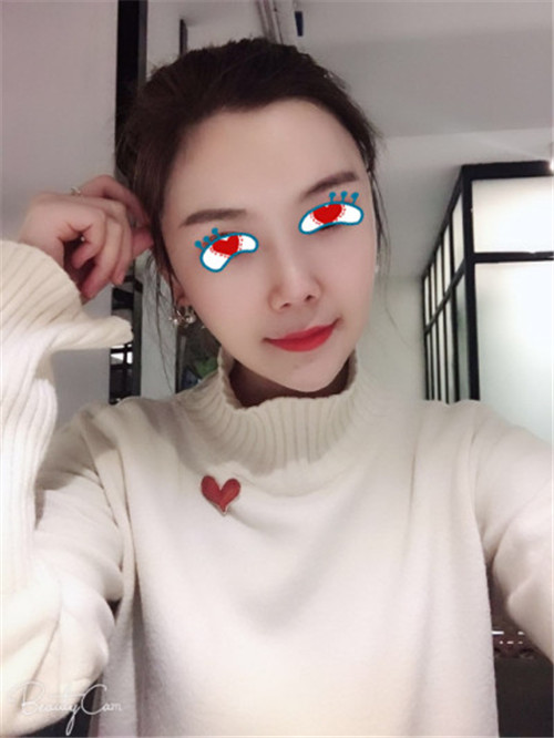 上海联合丽格范荣杰隆鼻怎么样?案例,价格