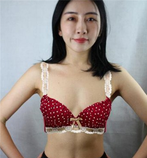 上海艺星彭才学丰胸怎么样?案例_价格