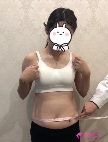 韩式共振吸脂减肥过程图片分享，快来看果好不好