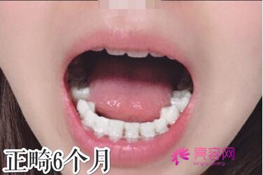 青海省人民医院口腔科靠谱吗？内附田广庆详细介绍+口碑评价