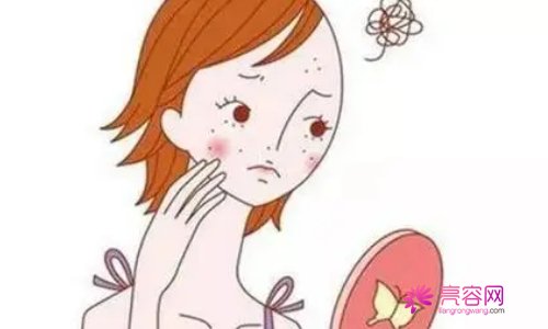 脸上长黄褐斑的原因有哪些？有什么方法可以去除？