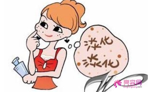 脸上长黄褐斑的原因有哪些？有什么方法可以去除？