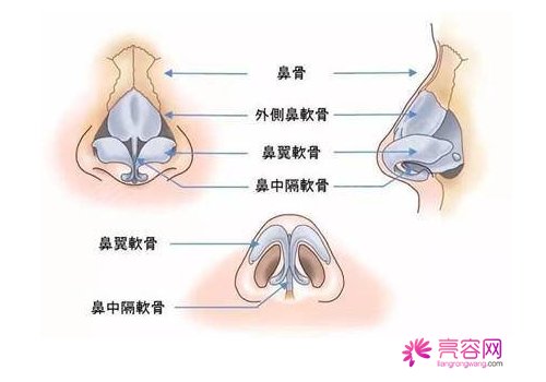 分段式假体隆鼻果好不好？快来看什么是分段式假体隆鼻