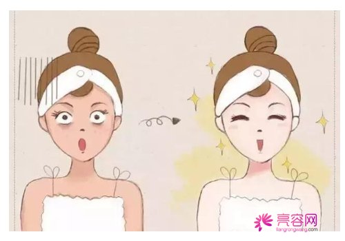 光子嫩肤对皮肤有伤害吗?术后注意事项有哪些