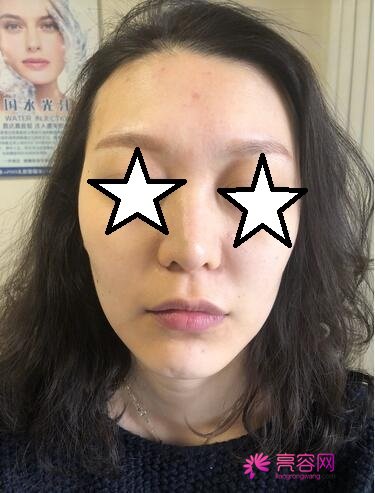 重庆王志军医生做除皱怎么样？价格,案例,口碑