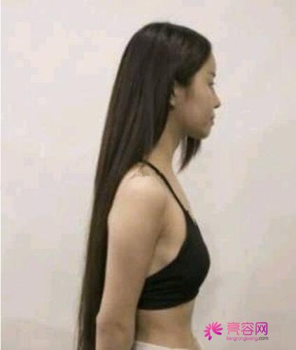 桂林华美整形医院综合实力怎么样？快看详细的介绍