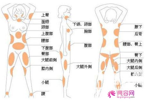 聚能吸脂真的有那么好吗？种种细节透露出好事将近