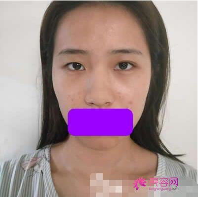 银川第一人民医院整形美容科隆鼻怎么样?高人气实力医生列表