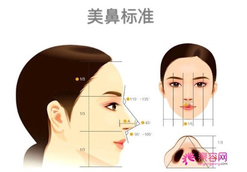 人工假体隆鼻法果怎么样?快来看详细介绍吧