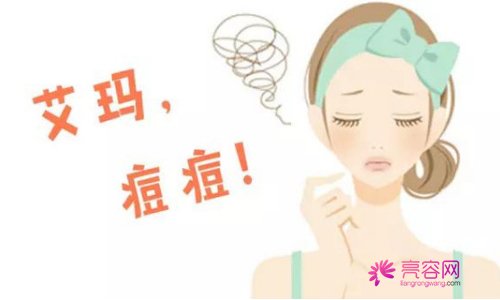 脉冲激光祛痘果怎么样？痘痘肌的美眉看过来！