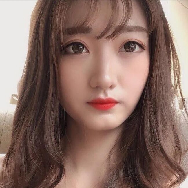 北京煤炭总医院割双眼皮怎么样?案例,价格