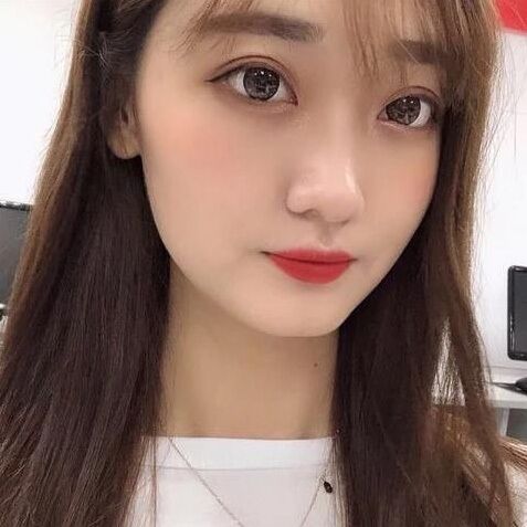 北京煤炭总医院割双眼皮怎么样?案例,价格