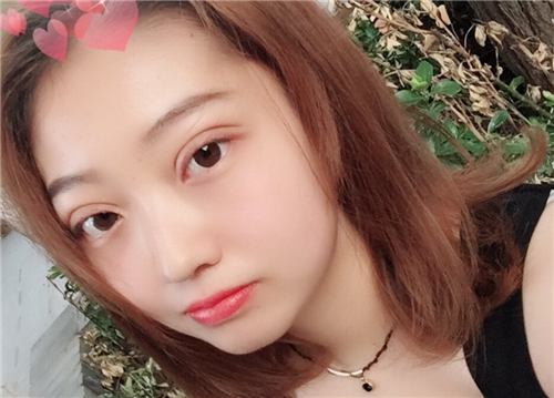 北京京民郭建玲割双眼皮怎么样?案例,价格